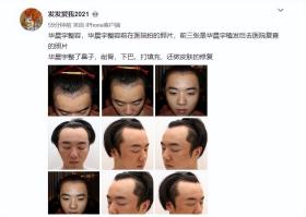 真的沒整？這些靠“換臉”翻身的男星，出道前后“判若兩人”！  第38張